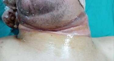 بعد اجراء العملية